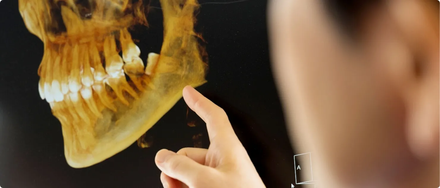 歯並びでお悩みの方へ