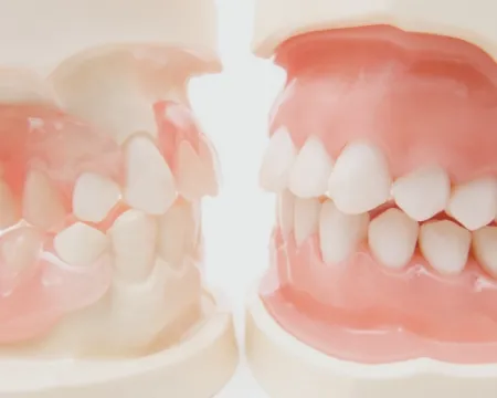 顎変形症の矯正治療_img