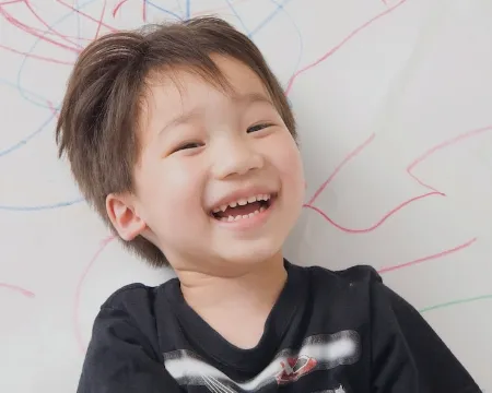 子どもの矯正治療_img